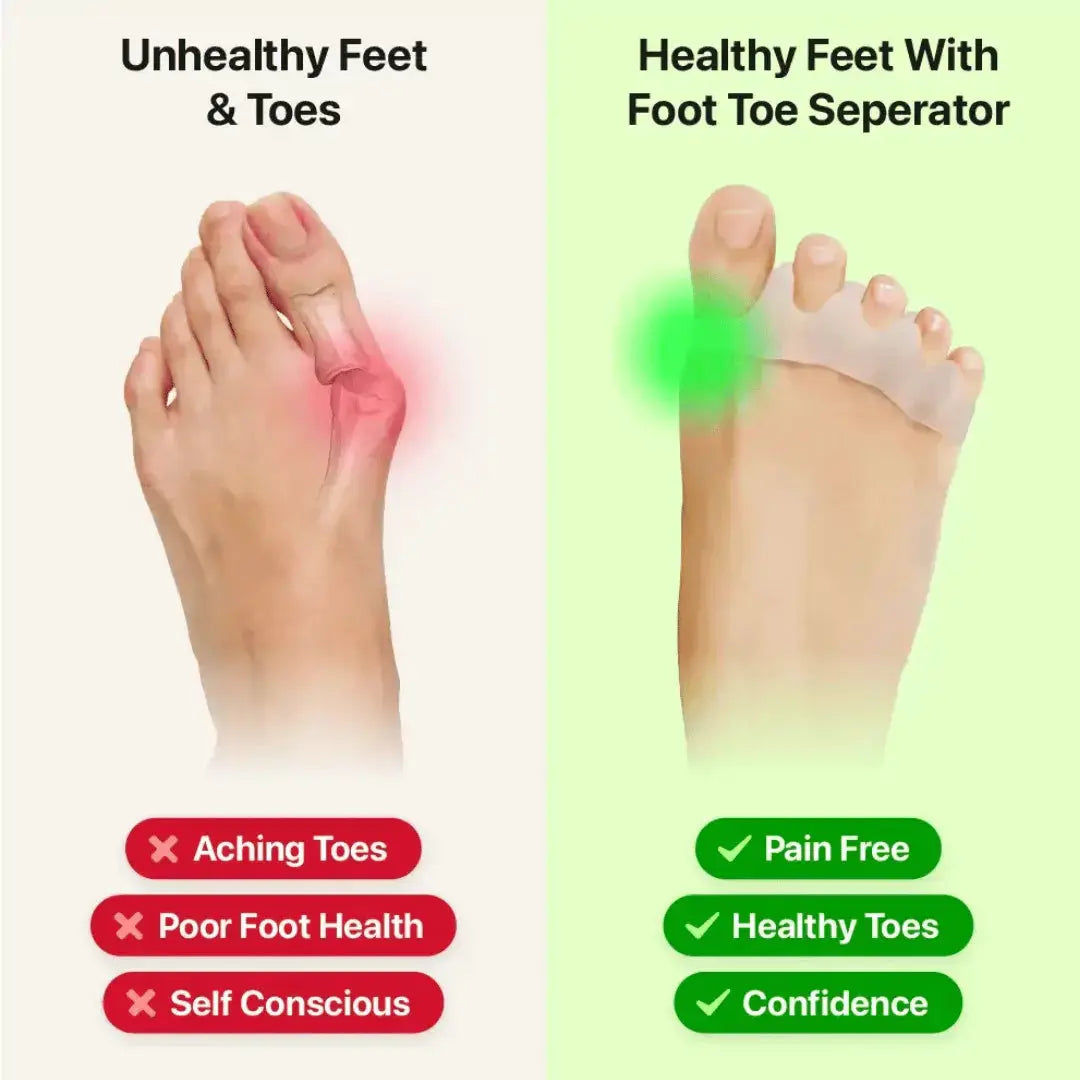 Oobend™ Toe Separator